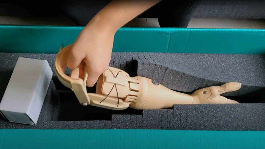 Revolutionizing Prosthetics: Affordable 3D-Printed Bionic Arms Powered by Muscle Signals